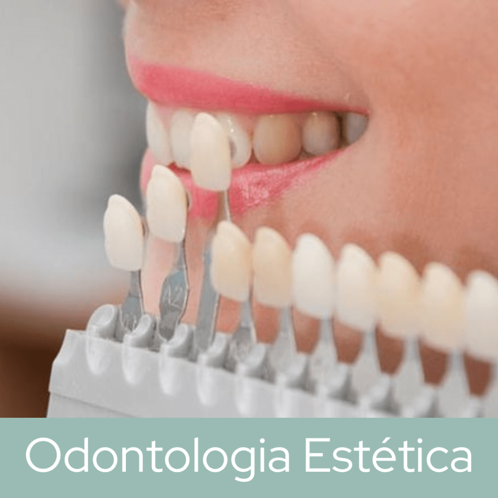 Odontologia estetica