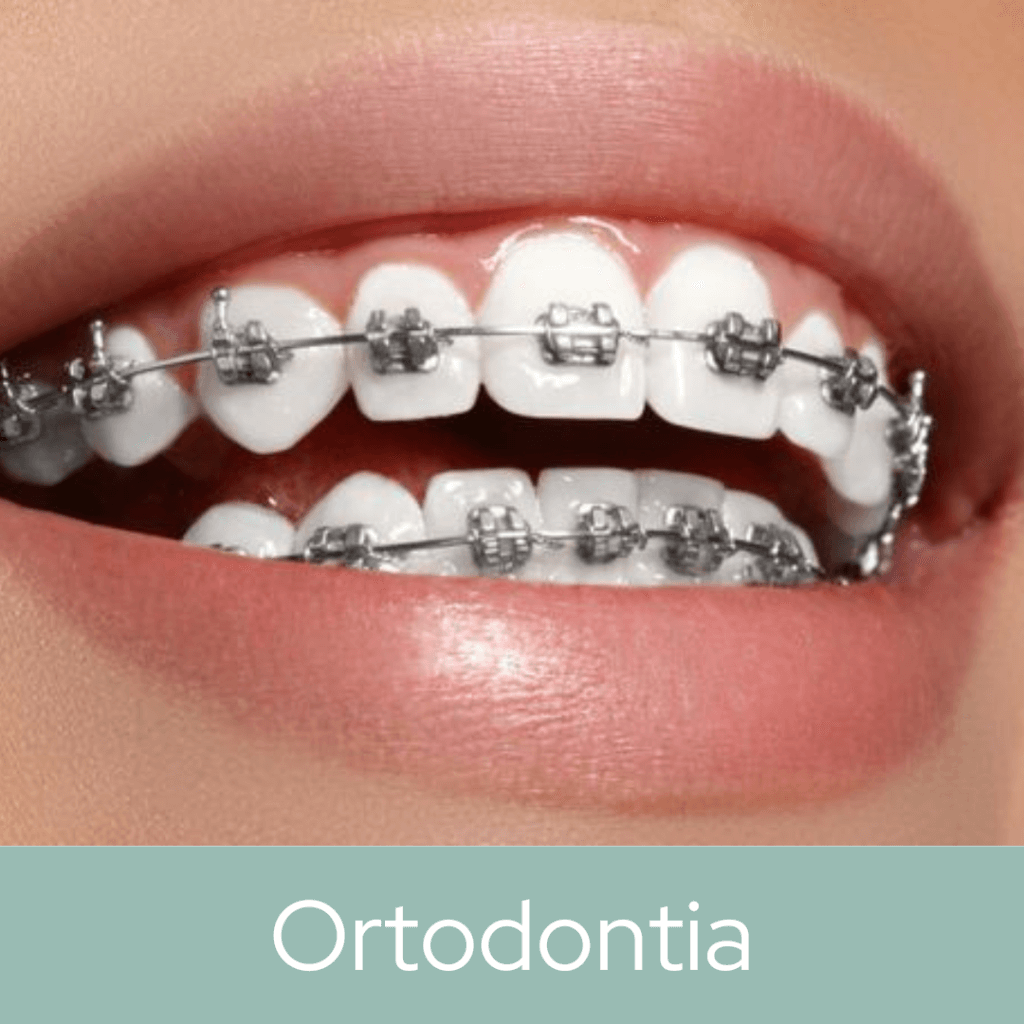 Ortodontia1